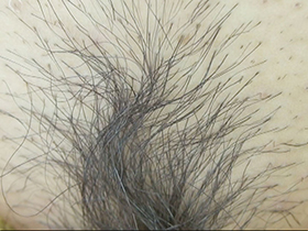 300人のまん毛3　サンプル画像06